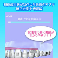 矯正歯磨きアプリが登場…8月8日は「歯並びの日」 画像