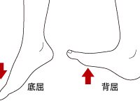 ねんざ後の足首を簡単に保護できる「リアライン・スプリント」