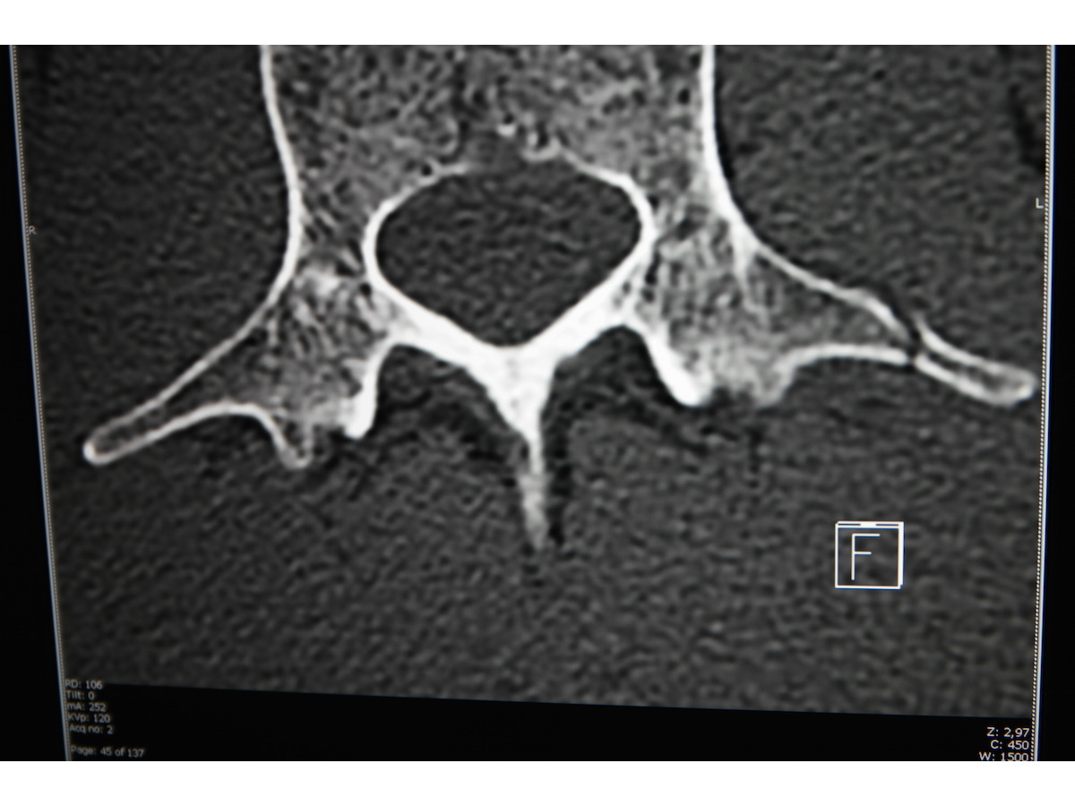 自転車ロード カンチェラーラが落車で脊椎骨折 今後のクラシック参戦が絶望的に Cycle やわらかスポーツ情報サイト