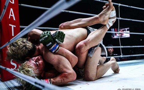 【RIZIN】鈴木千裕、朝倉未来にTKO負けも……再び“王座奪還”を誓う 試合4日後に初投稿「俺の前に立つ奴全員覚悟しとけ」 画像