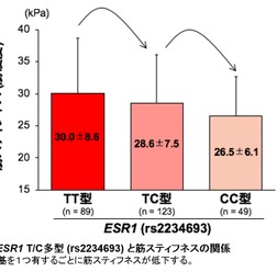 スポーツ選手の肉離れなどの筋損傷リスクに関連する遺伝要因を解明…順天堂大学