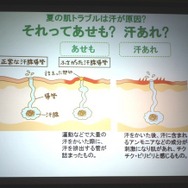 夏本番をまえに「あせも」と「汗あれ」、違いと予防と対処法